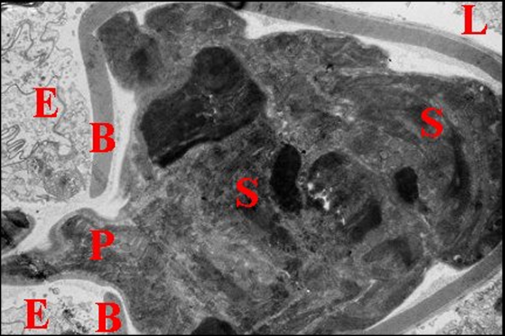Spermatophore déférent 1