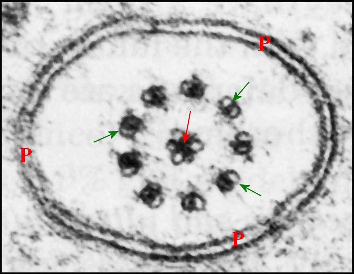 Spermatozoïde 2