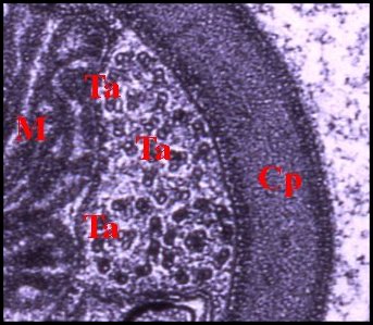 Spermatozoide Leptoneta