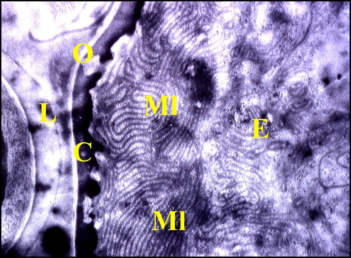 Telema apical