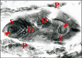 Telema spermatheque spermatophore