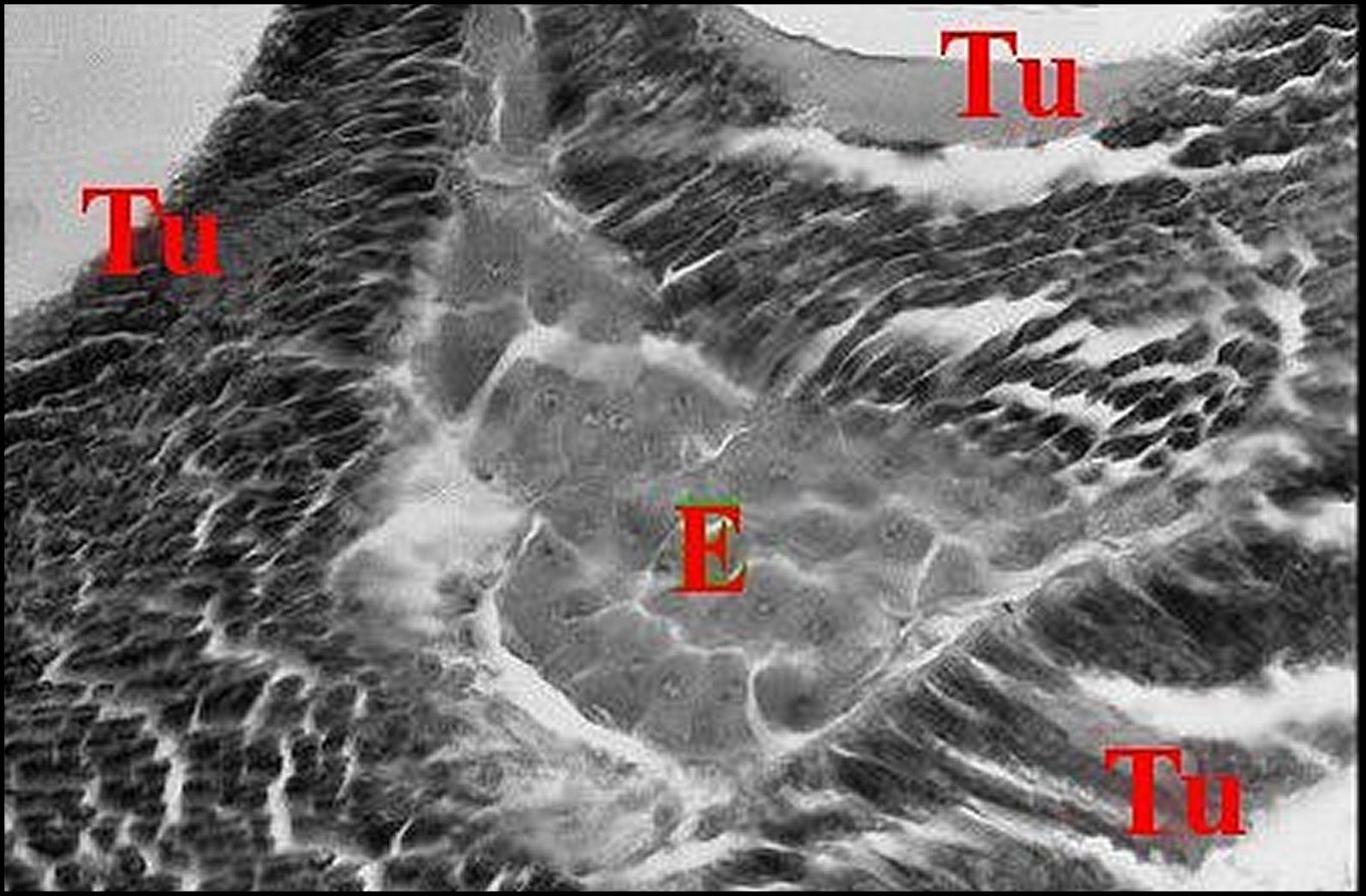 Endocrinoide Celaenia 2