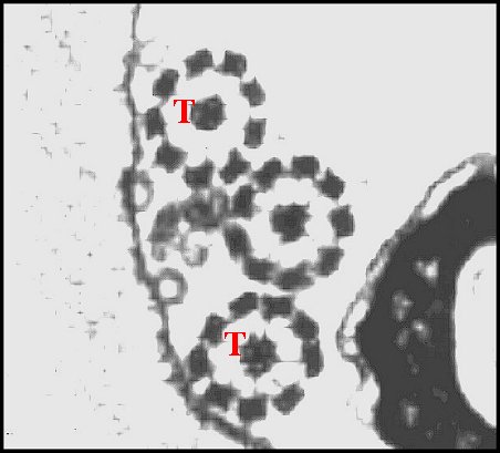 Triplet Pholcus