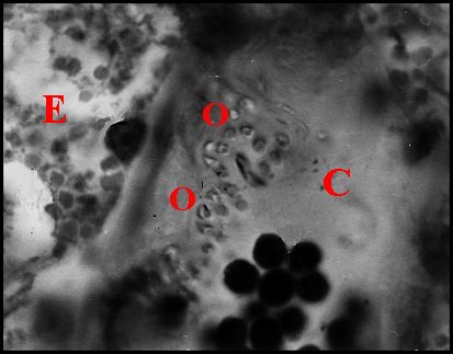 Tube Dysdera