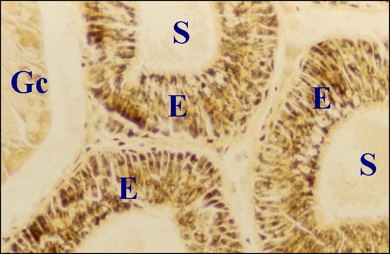 Tubuliformes 1