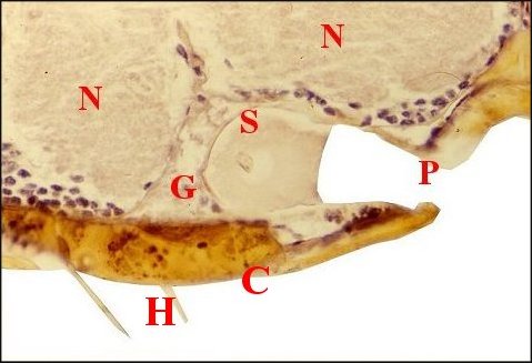 Wendilgarda histo pore