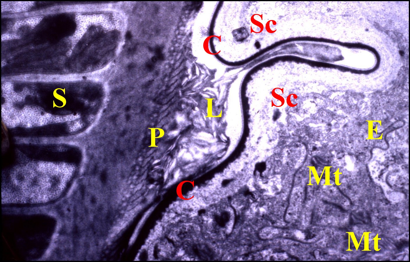 Spermathque pole basal